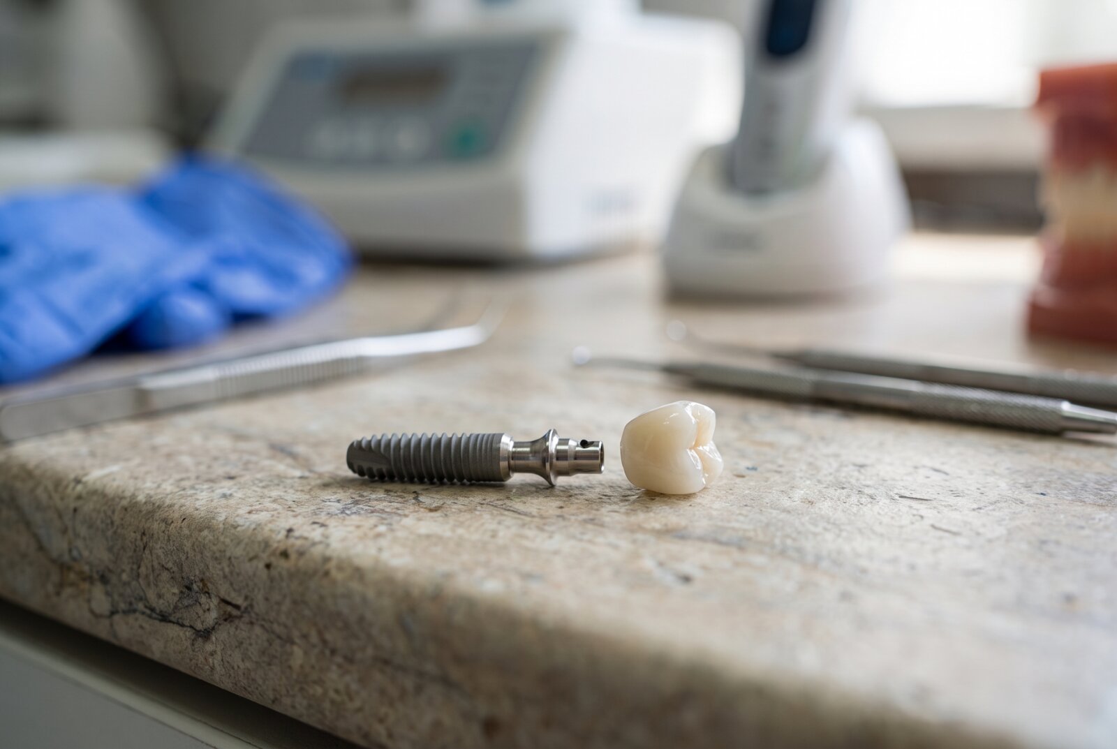 Close up of a dental implant model showing the titanium post abutment and crown on a clinic countertop in Reseda