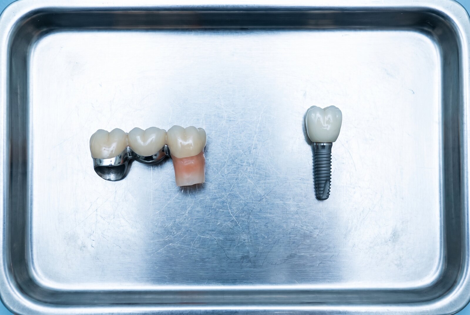 Dental bridge model and implant model displayed side by side on a tray for patient comparison in Reseda